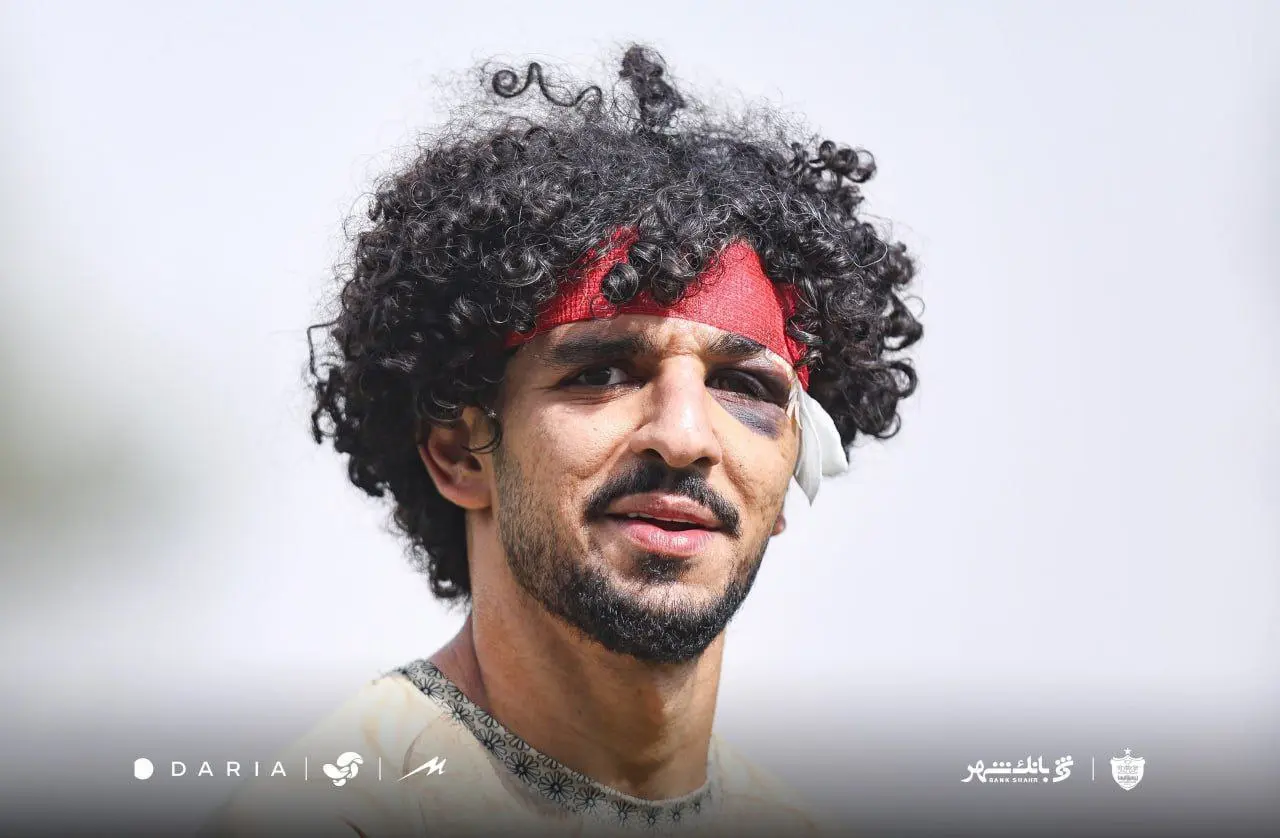 تصویر تکان‌دهنده از تمرین امروز سرخ‌ها؛ چشمِ خونینِ مدافع پرسپولیس همه را شوکه کرد!