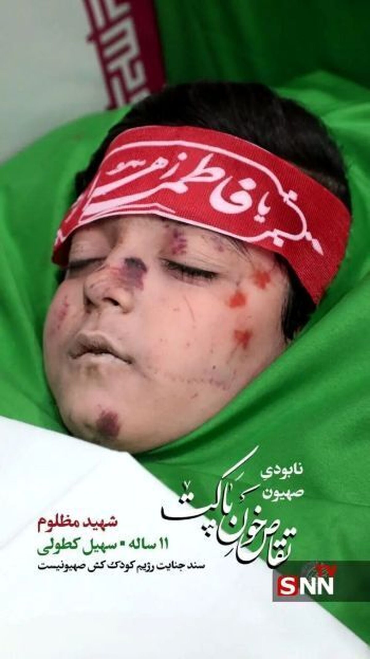 انتشار تصویر پیکر مطهر سهیل کطولی، شهید مظلوم ۱۱ ساله (عکس) +۱۶