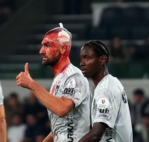 مصدومیت شدید سردار دورسون در بازی کوجالیاسپور مقابل باشاکشهیر مصدومیت شدید سردار دورسون در بازی کوجالیاسپور مقابل باشاکشهیر