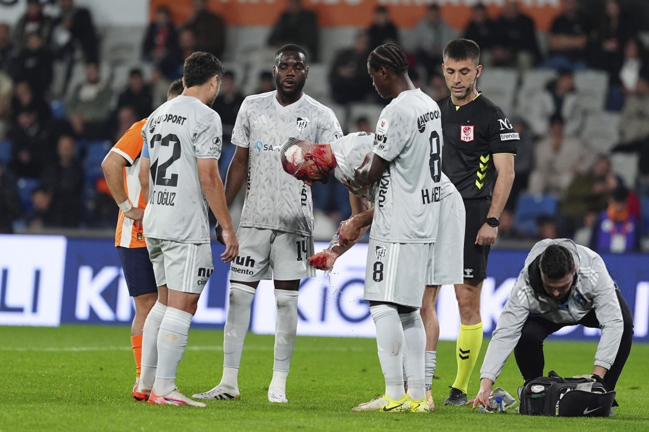 فوران خون مهاجم فصل گذشته پرسپولیس و ۱۲ بخیه روی سر سردار دورسون!