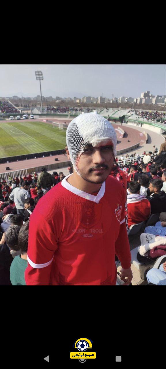 حاشیه منفی دربی ۱۰۶؛ سنگ‌پرانی و جراحت یک هوادار +عکس