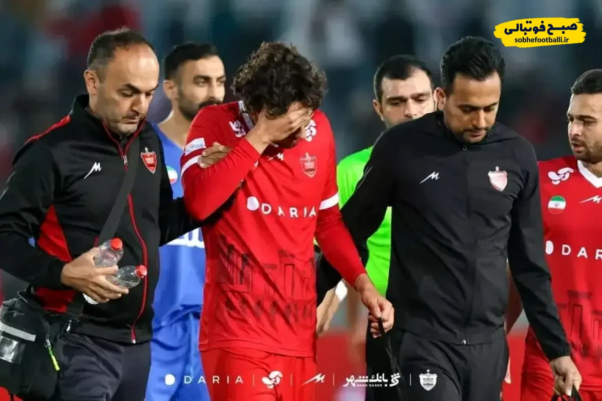 مارکو باکیچ دربی را از دست داد؟