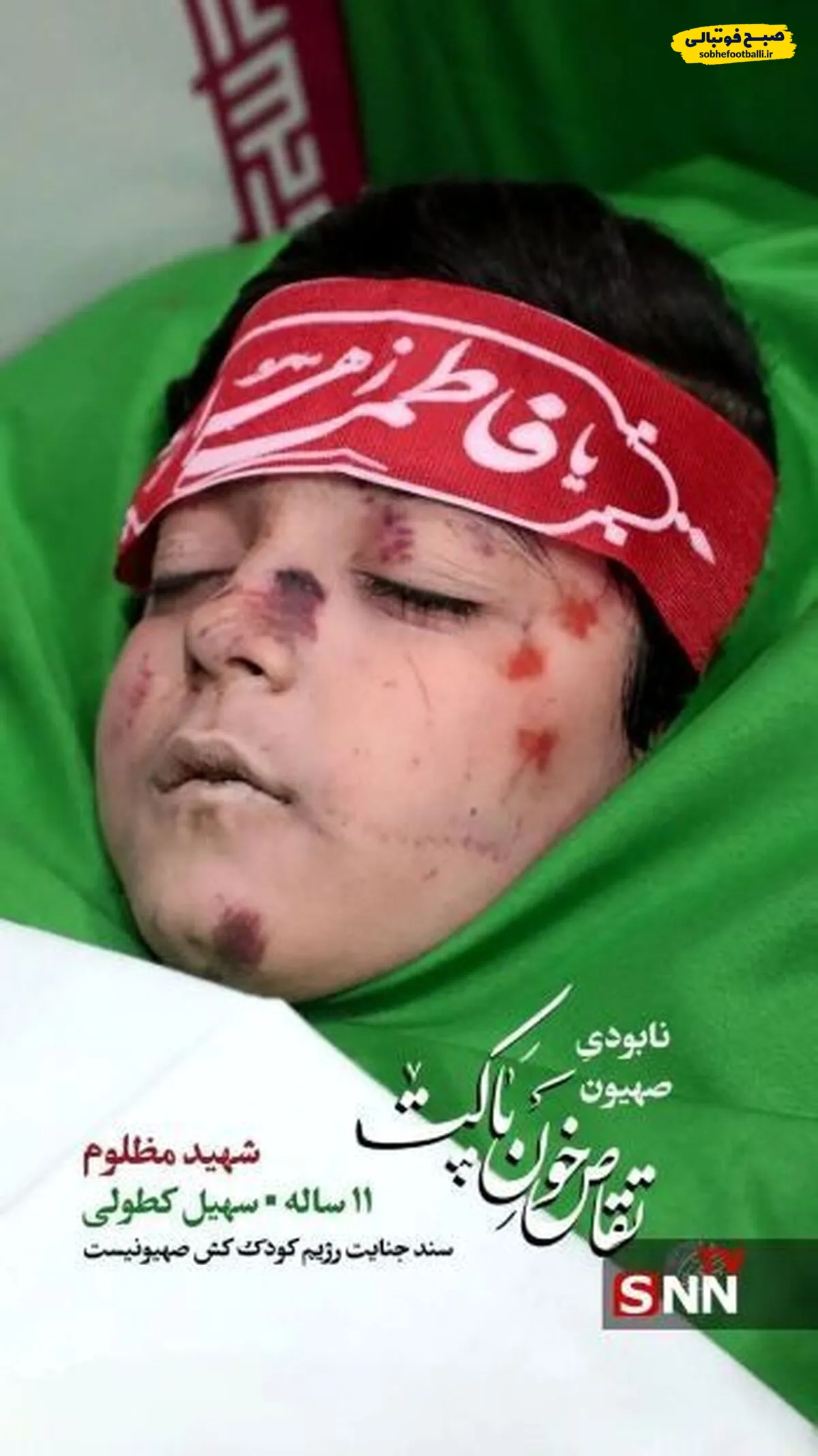 انتشار تصویر پیکر مطهر سهیل کطولی، شهید مظلوم ۱۱ ساله (عکس) +۱۶