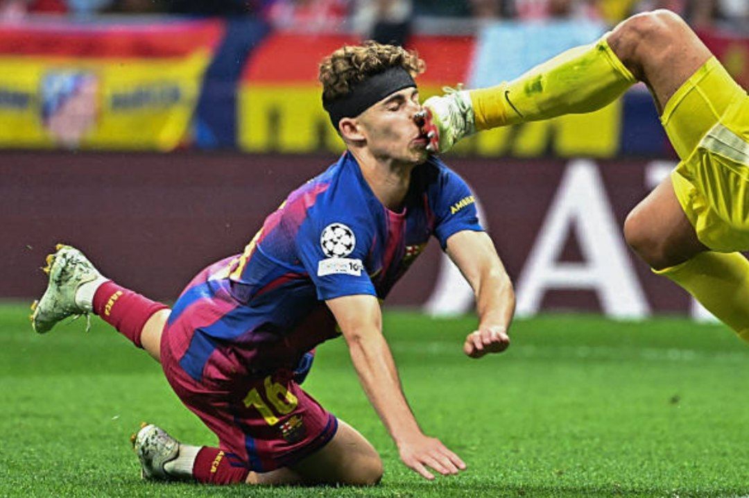 این پنالتی نبود؟/ شوکهکنندهترین برخورد سال لیگ قهرمانان + عکس این پنالتی نبود؟/ شوکهکنندهترین برخورد سال لیگ قهرمانان + عکس