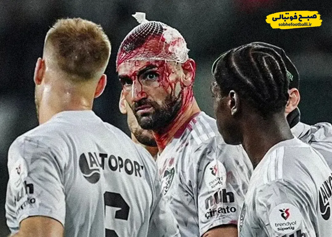 فوران خون مهاجم فصل گذشته پرسپولیس و ۱۲ بخیه روی سر سردار دورسون!