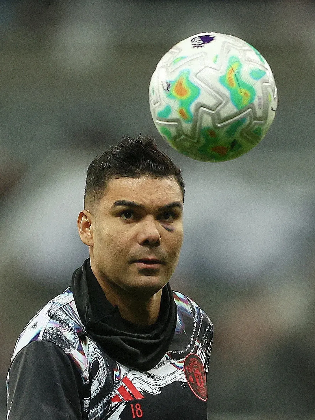 کاسمیرو با چشم کبود