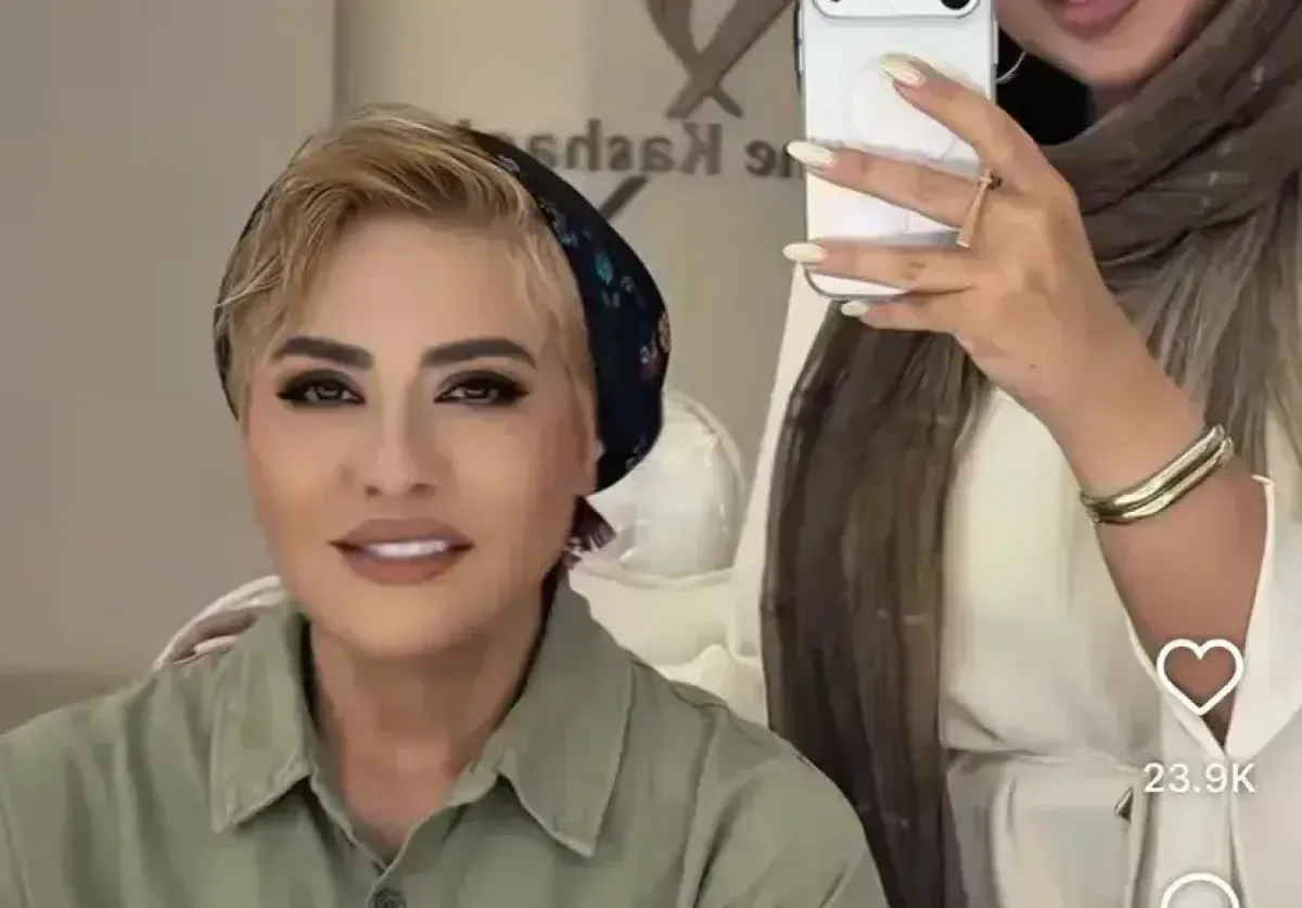 تغییر چهره رابعه اسکویی