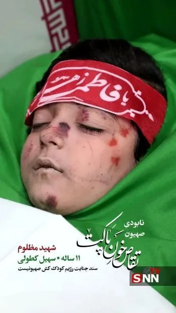 انتشار تصویر پیکر مطهر سهیل کطولی، شهید مظلوم ۱۱ ساله (عکس) +۱۶