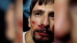 فیلم حادثه هولناک در ورزشگاه پارس شیراز | سقوط قطعه سقف روی هوادار