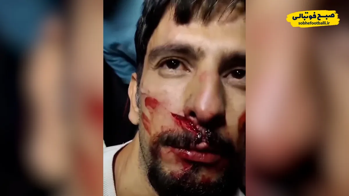 فیلم حادثه هولناک در ورزشگاه پارس شیراز | سقوط قطعه سقف روی هوادار